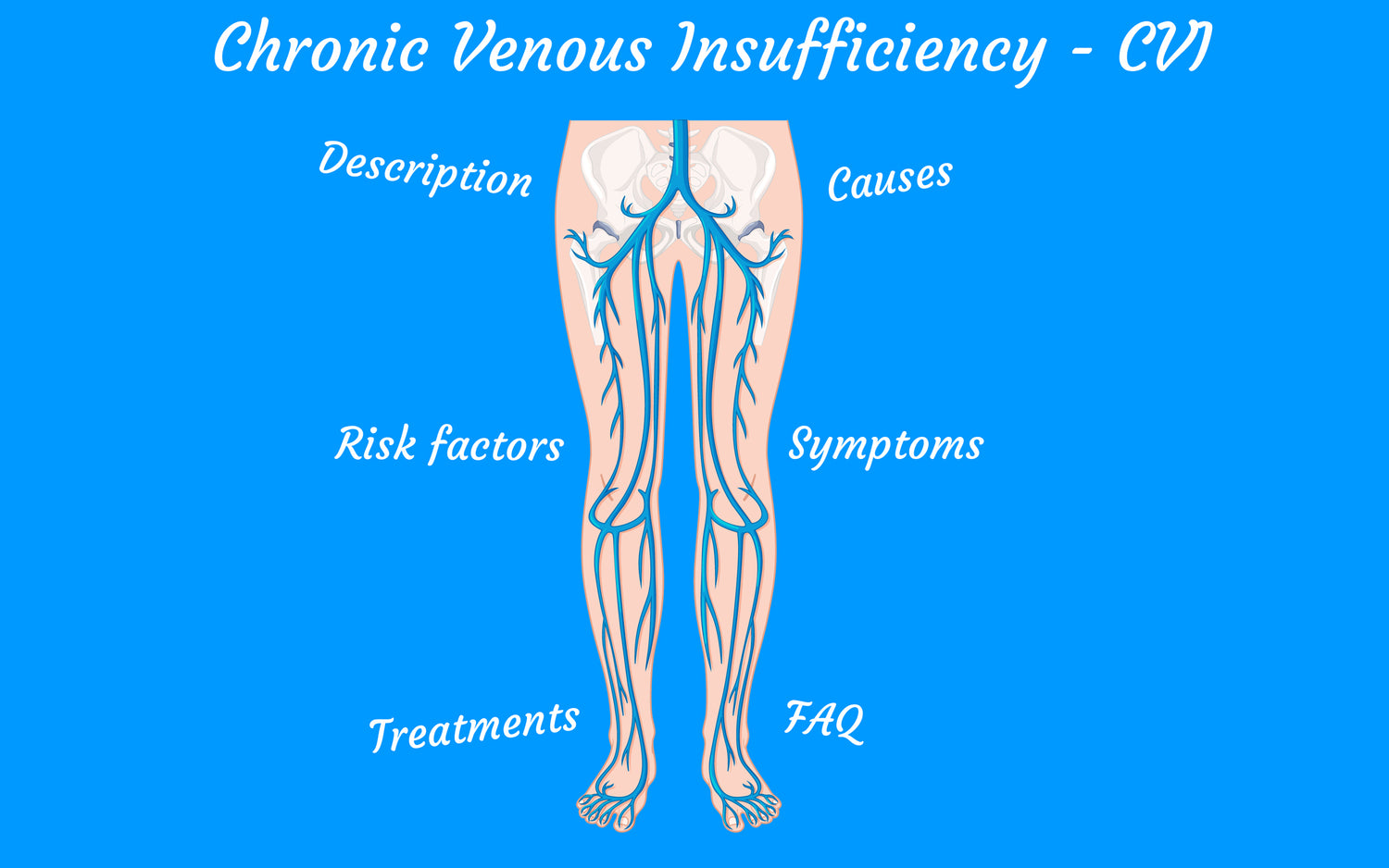 Chronic venous insufficiency (CVI): Symptoms - Causes - Treatments
